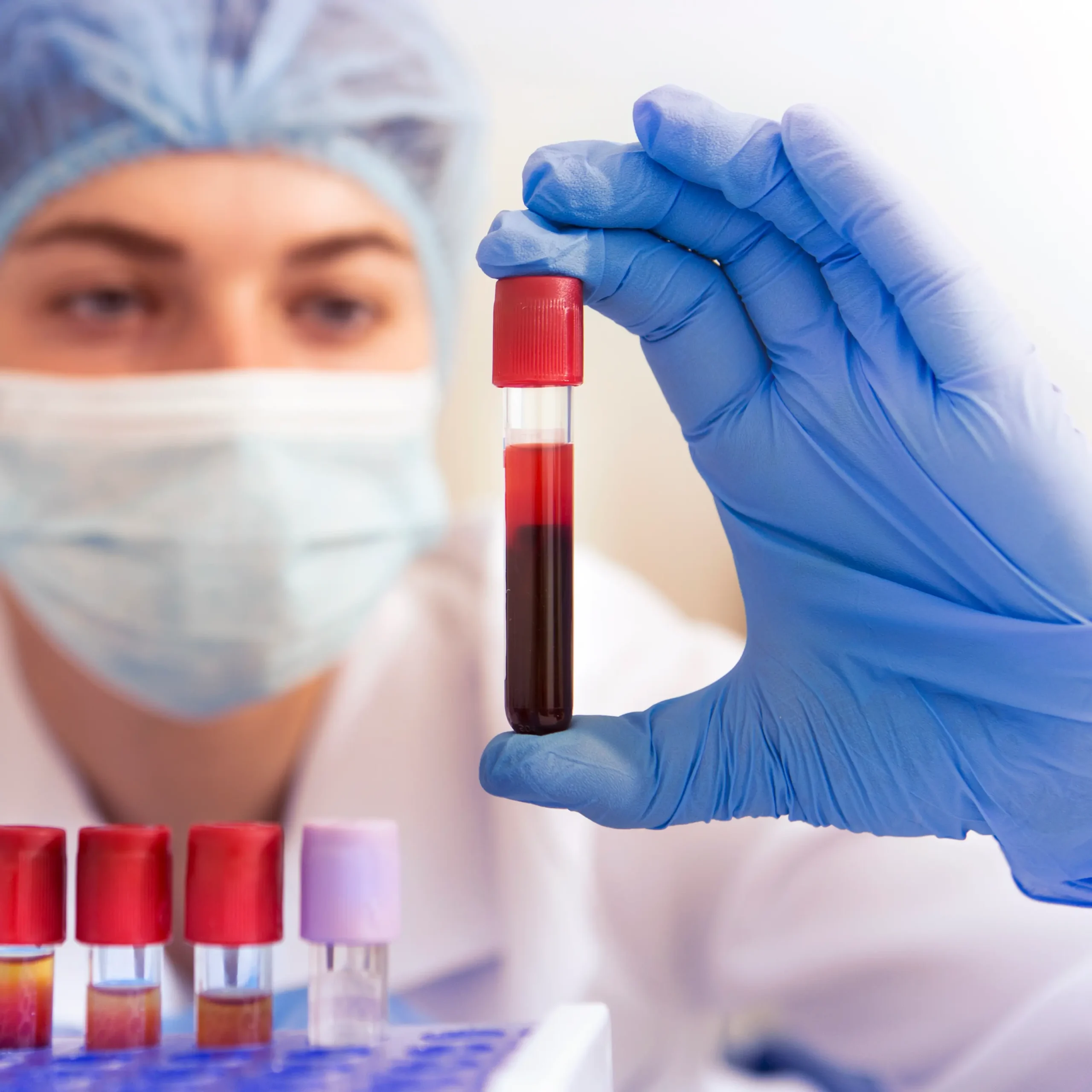 Point-of-Care Testing